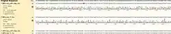 DNA Sequence, showing a mutation in Sample #1.