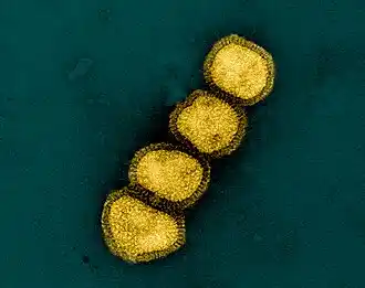 Colorized transmission electron micrograph of influenza A/H1N1 virus particles (yellow). Influenza A/H1N1 can infect both humans and animals, including birds and pigs, and is one of several strains related to seasonal flu outbreaks.