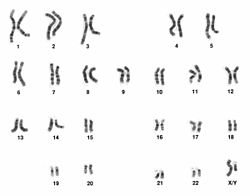 A karyotype of a human male; the first 22 chromosome pairs are known as the autosomes.